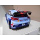 HYUNDAI i20 WRC RALLY TOUR CORSE 2017 NEUVILLE 1:18 ALTAYA IXO
